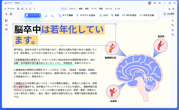 pdnob-v2-text-annotations-move-with-edits